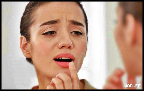 ما هي المشكلات الصحية التي يمكن أن يسببها فيكسوفينادين