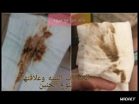 نزول إفرازات بنية وقت الدورة بدون دم هل أصلي