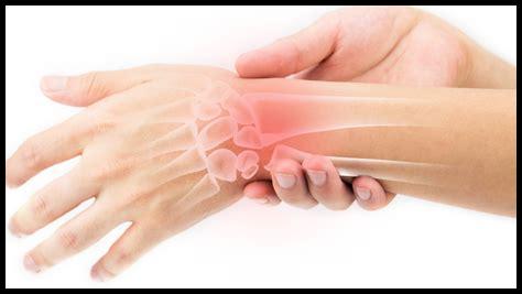 هل بريدنيزون فعال في علاج التهاب المفاصل الروماتويدي؟