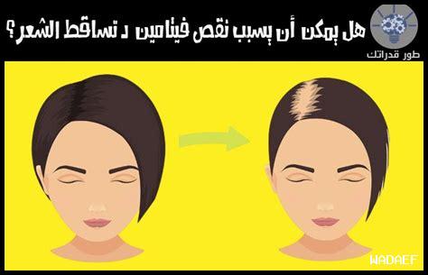 هل بريدنيزون يسبب تساقط الشعر؟