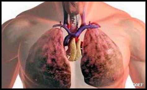 هل يؤثر إيبوبروفين على الجهاز الهضمي؟