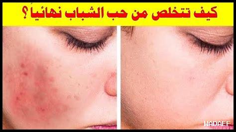 كيف نحمي الحب