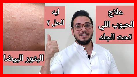 ما هو علاج الحب المفقود ما هو علاج الحب المفقود